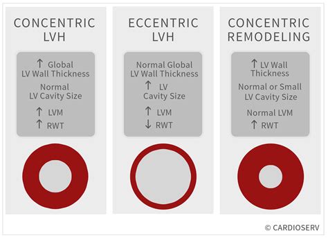 eccentric vs concentric cardiomyopathy.